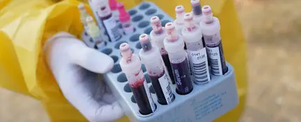 Coronavirus: Los nuevos síntomas de coronavirus Coronavirus: Los nuevos síntomas de coronavirus