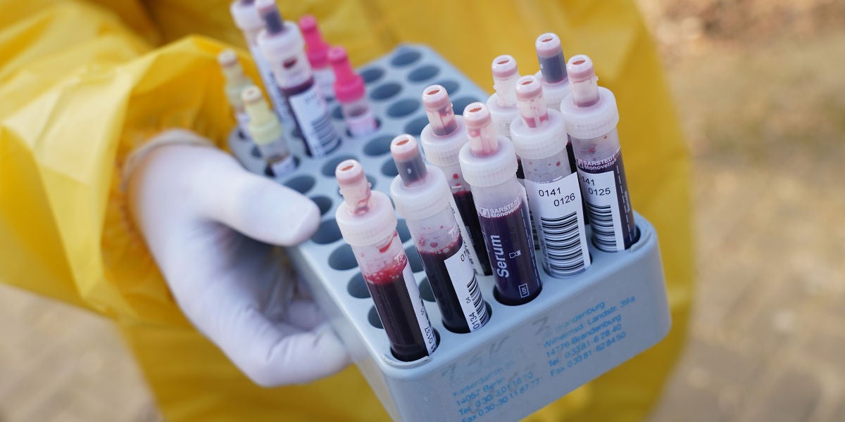 Coronavirus: Los nuevos síntomas de coronavirus