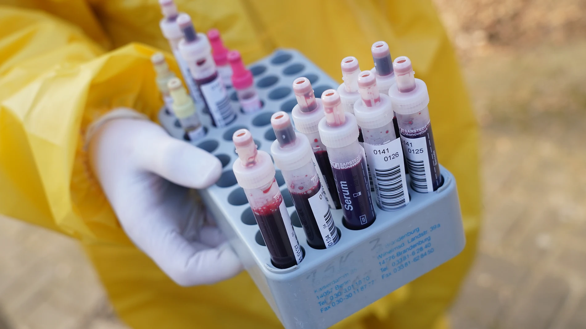 Coronavirus: Los nuevos síntomas de coronavirus Coronavirus: Los nuevos síntomas de coronavirus