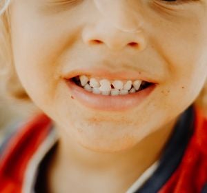 Primer plano de los dientes de un niño Primer plano de los dientes de un niño