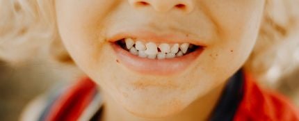 Primer plano de los dientes de un niño