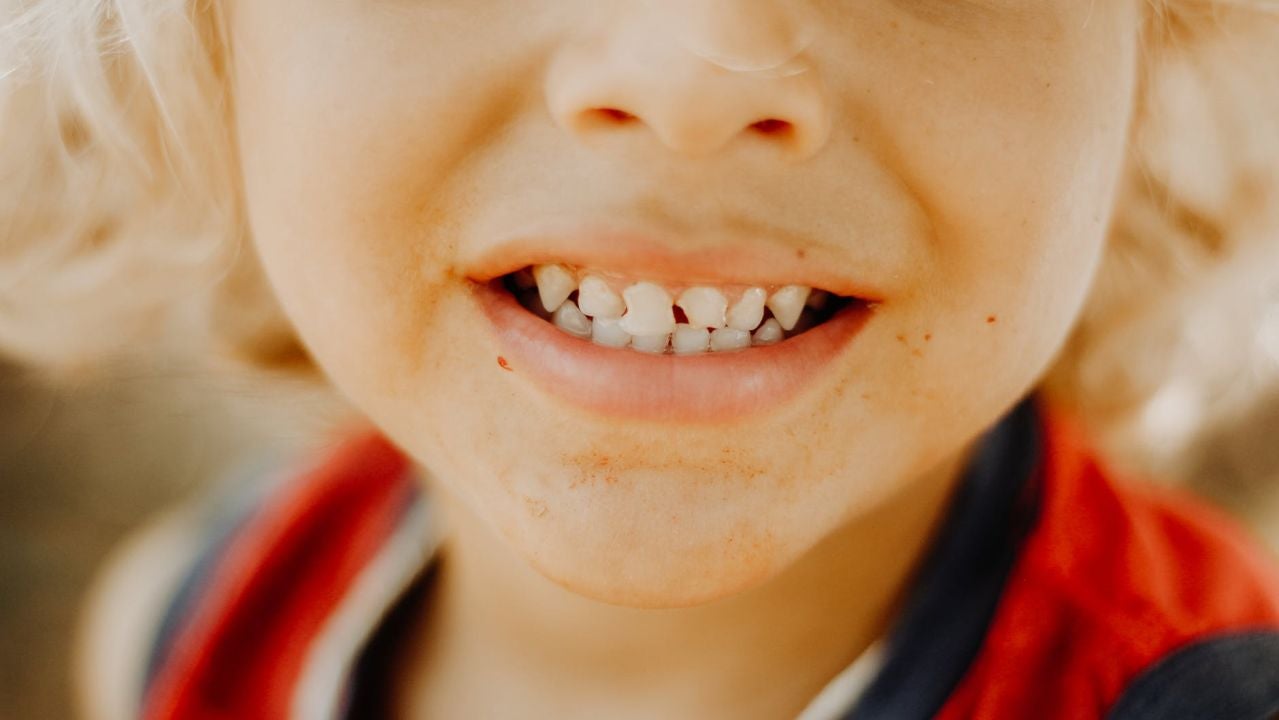 Primer plano de los dientes de un niño Primer plano de los dientes de un niño