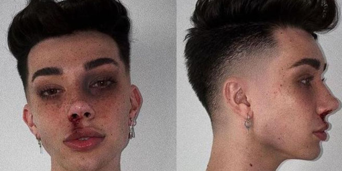 El 'Mugshot Challenge' de James Charles que luego borró