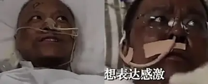 El doctor Yi Fan y el doctor Hu Weifeng, tras recibir el tratamiento El doctor Yi Fan y el doctor Hu Weifeng, tras recibir el tratamiento