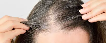 Canas Canas