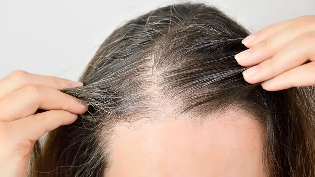 Canas