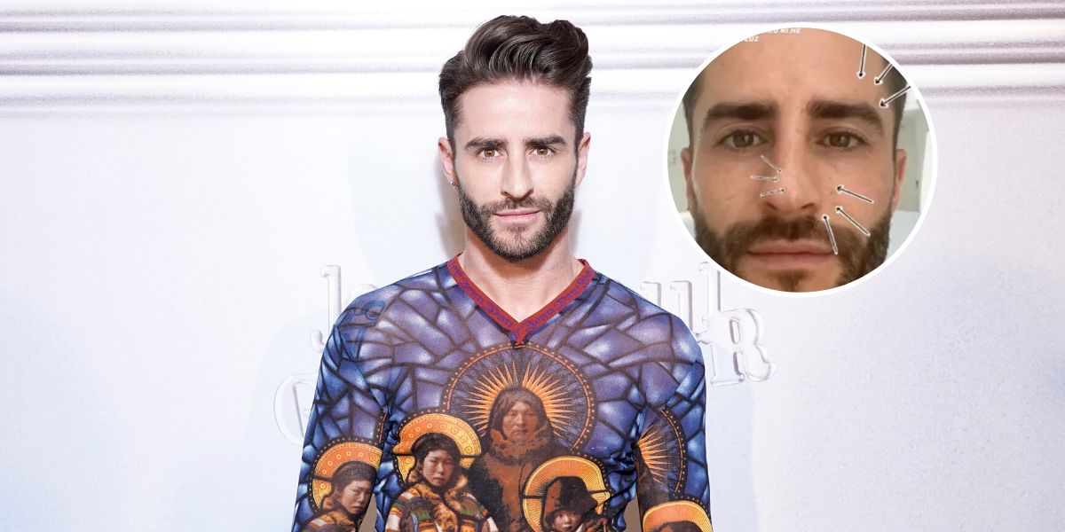 Pelayo Díaz muestra sus manchas en la piel