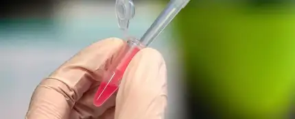 Test de coronavirus. Test de coronavirus.