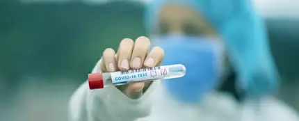 Una muestra de un test de Covid19 Una muestra de un test de Covid19