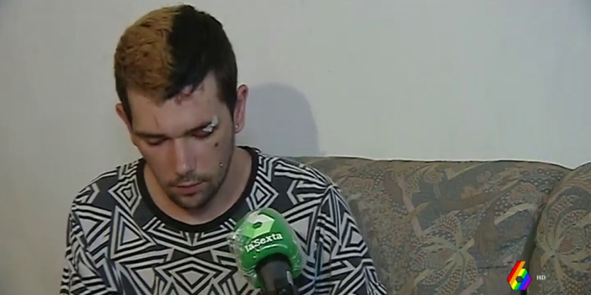 Se investiga una presunta agresión homófoba a un joven en el Hospital General de Castellón: "Me estamparon la cabeza contra el suelo"