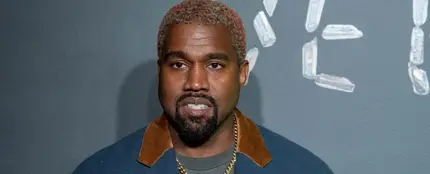Kanye West sufre un trastorno bipolar Kanye West sufre un trastorno bipolar