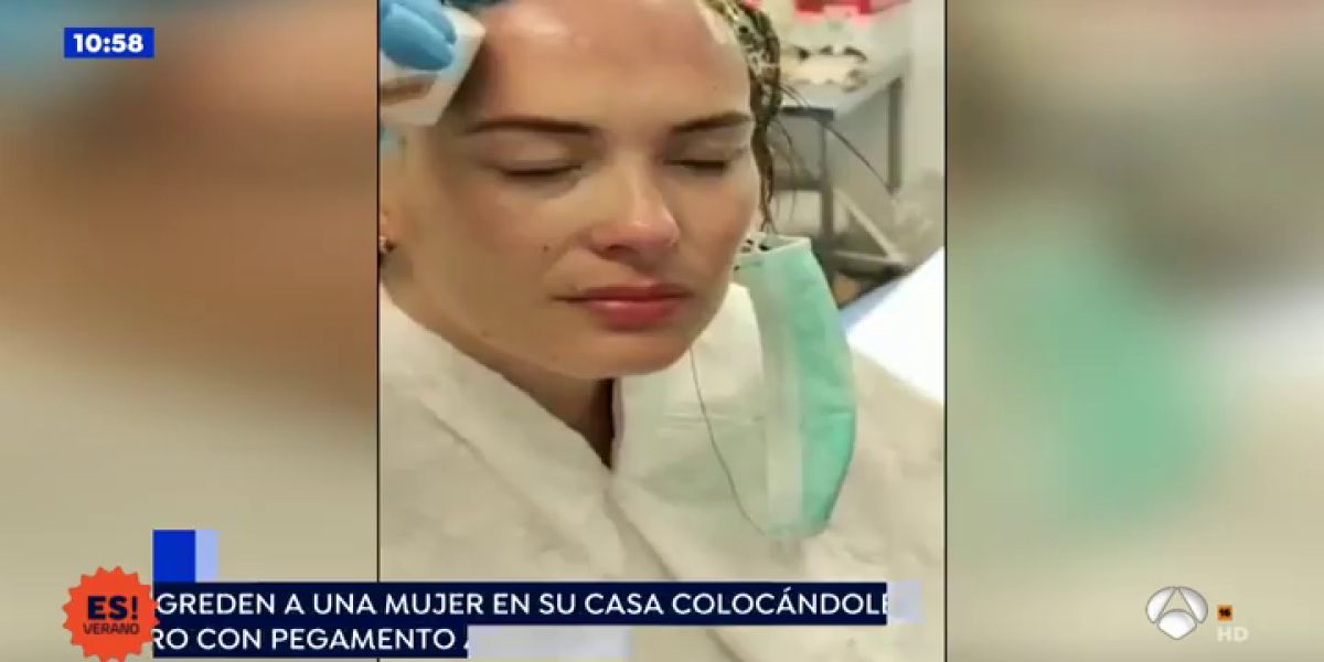 Agredida con un gorro de pegamento abrasivo cuando abría la puerta de su casa en Valencia