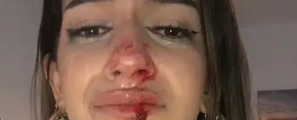 Agresión tránsfoba en Barcelona Agresión tránsfoba en Barcelona
