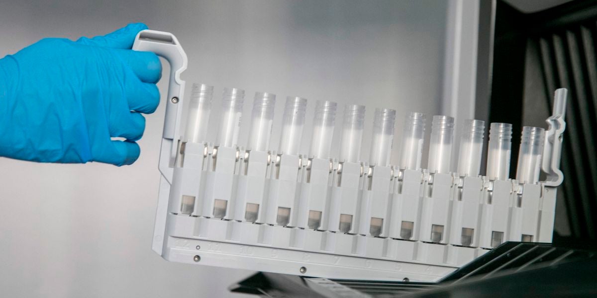 Probetas para los test PCR en un laboratorio de análisis.
