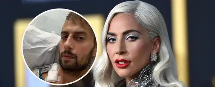 Ryan Fischer, el paseador de perros de Lady Gaga Ryan Fischer, el paseador de perros de Lady Gaga