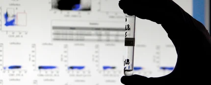 Test para detectar anticuerpos de covid-19 Test para detectar anticuerpos de covid-19