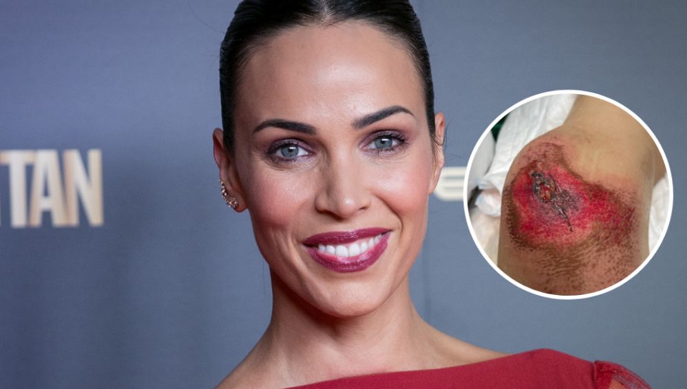 Nerea Garmendia muestra las impactantes tras su accidente
