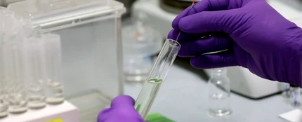 Una vacuna contra el COVID Una vacuna contra el COVID