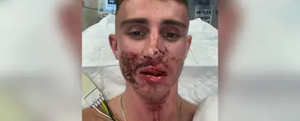 Agreden brutalmente al taekwondista Jack Woolley Agreden brutalmente al taekwondista Jack Woolley