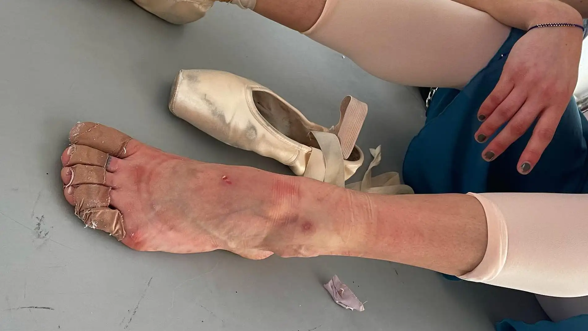 Los pies de María Pedraza tras hacer ballet