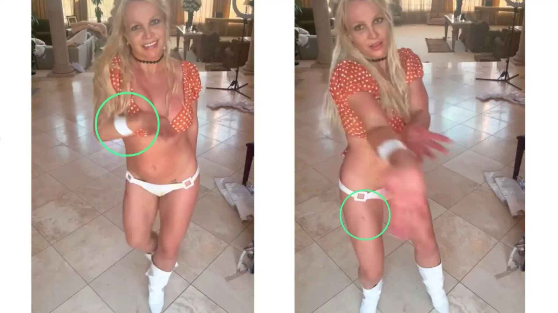 Las heridas de Britney Spears tras el baile del cuchillo.
