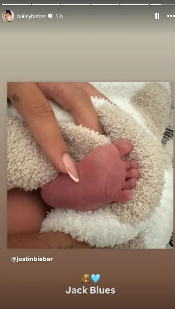 Hailey Bieber ha compartido la publicación de Justin Bieber Hailey Bieber ha compartido la publicación de Justin Bieber
