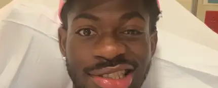 El cantante Lil Nas X con el lado derecho de la cara paralizado. El cantante Lil Nas X con el lado derecho de la cara paralizado.