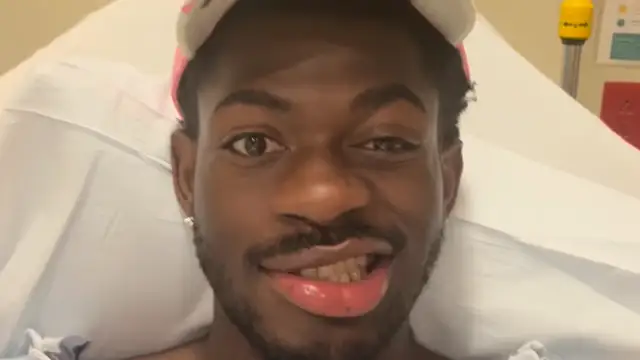 El cantante Lil Nas X con el lado derecho de la cara paralizado.