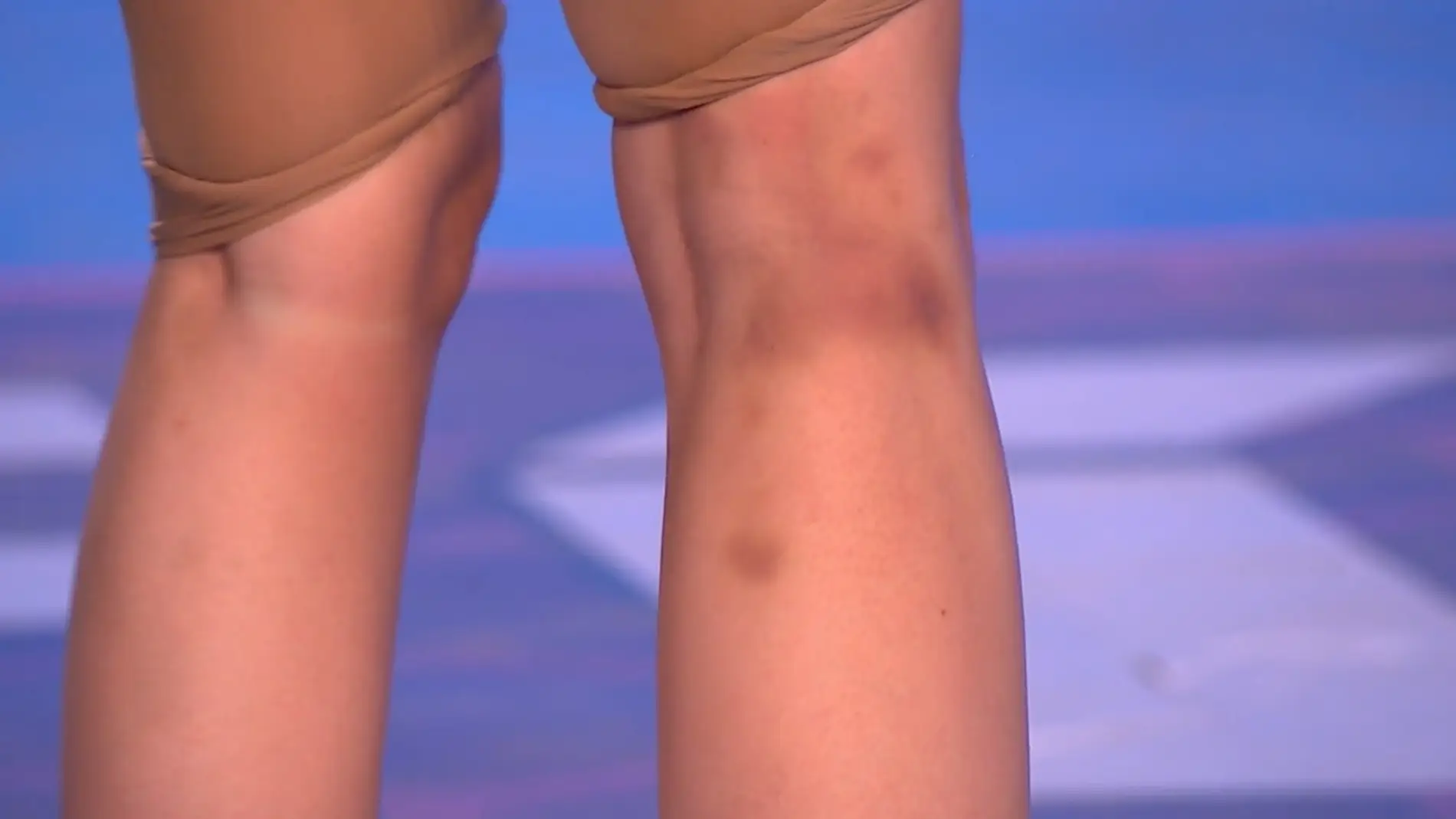 Los moratones de Eva Soriano en 'El Desafío' Los moratones de Eva Soriano en 'El Desafío'